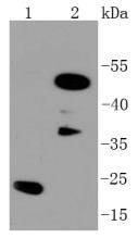 Anti-C/EBP Beta Antibody (7Q839)