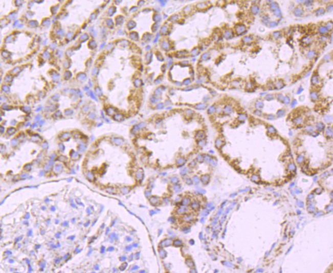Anti-ATP5B Antibody (8V910)