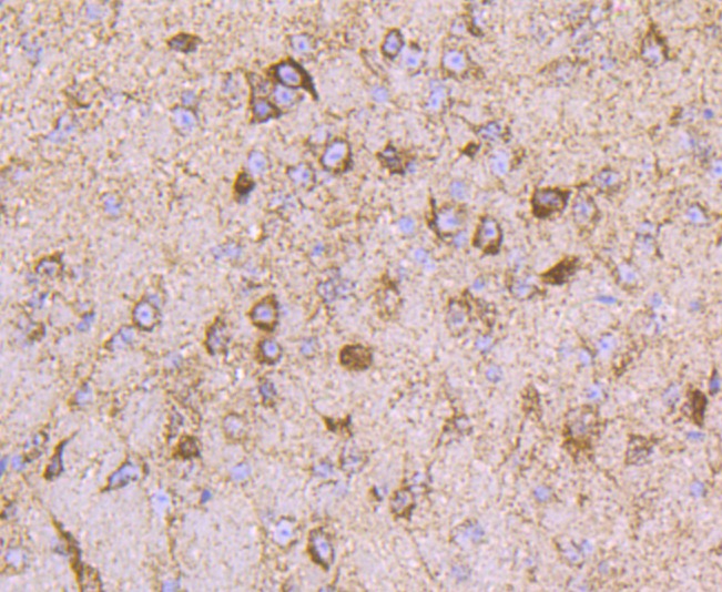 Anti-ATP5B Antibody (8V910)