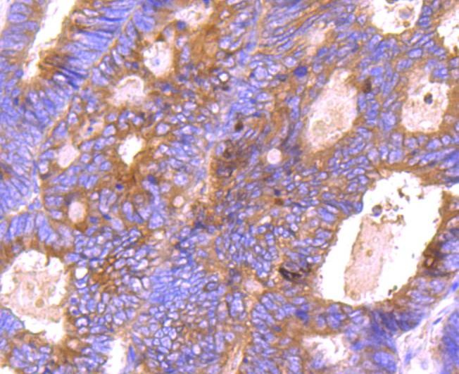 Anti-BCL-XL Antibody (3K493)