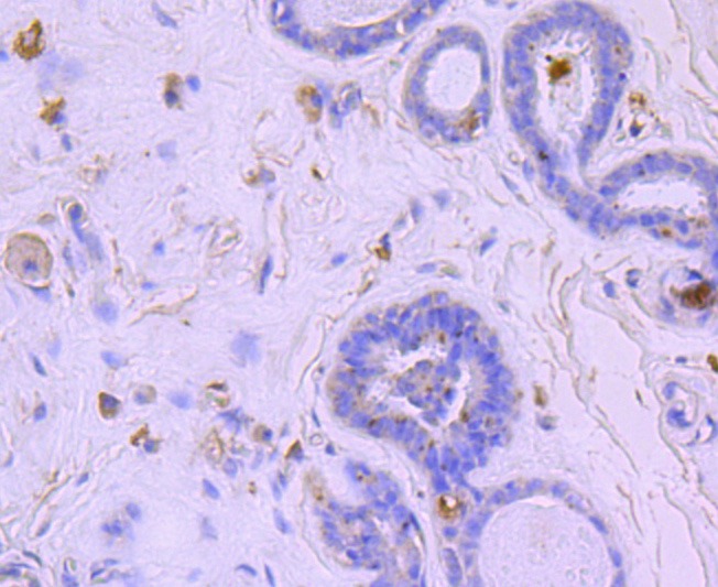 Anti-BNIP3 Antibody (3L227)