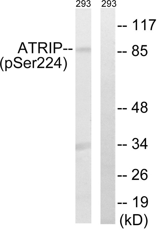 Anti-Phospho-ATRIP (Ser224) Polyclonal Antibody
