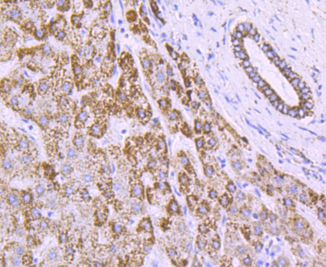 Anti-ATP5B Antibody (8V910)