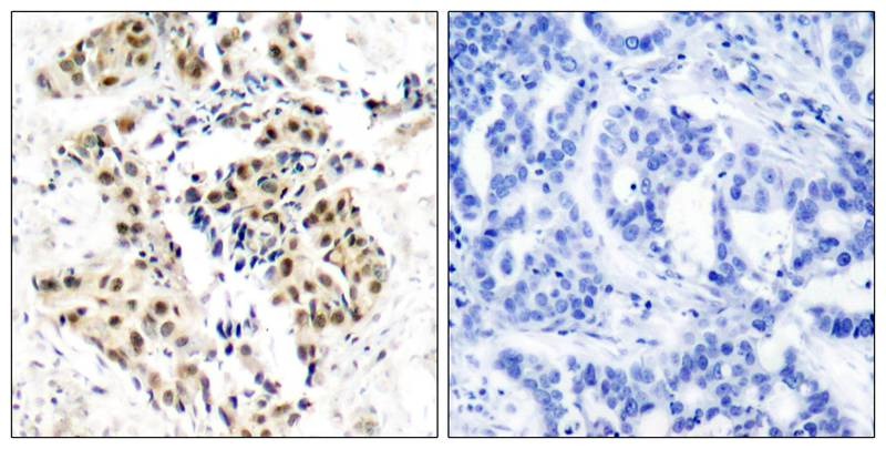 Anti-Phospho-ATM (Ser1981) Polyclonal Antibody