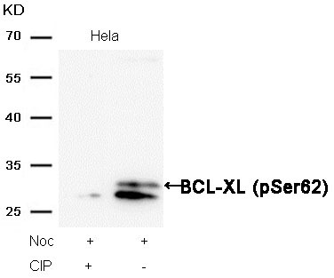 Anti-Phospho-BCL-XL (Ser62) Polyclonal Antibody 2