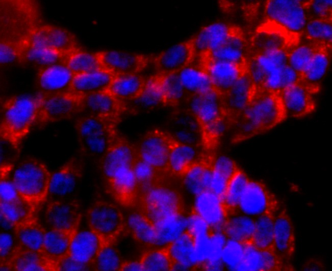 Anti-ATP5B Antibody (8V910)