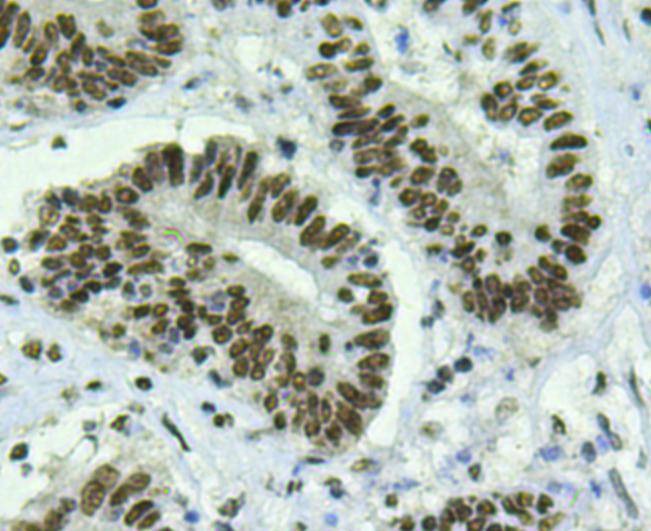 Anti-BMI-1 Antibody (8M743)