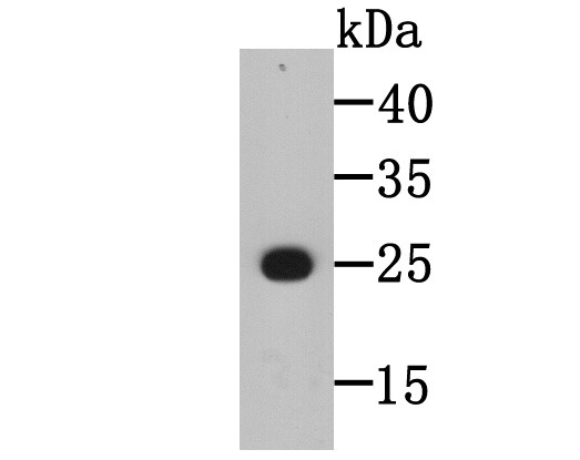 Anti-BLCAP Antibody (7F556)