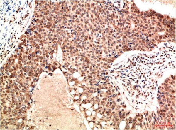 Anti-ATM Antibody (1W166)