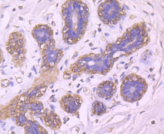 Anti-BLCAP Antibody (7F556)
