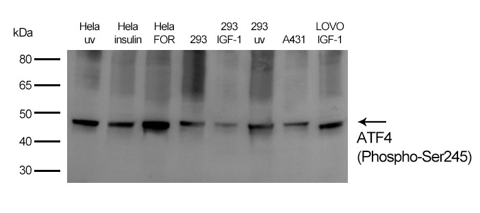 Anti-Phospho-ATF-4 (Ser245) Polyclonal Antibody 2
