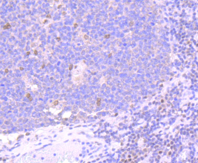 Anti-BMI-1 Antibody (4I124)