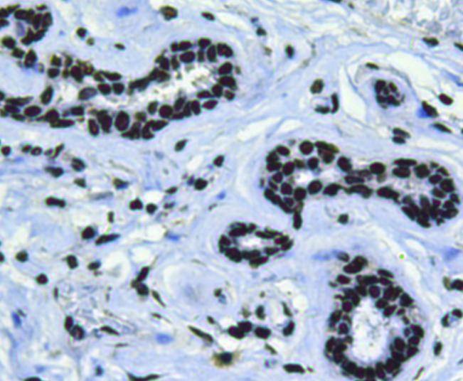 Anti-BMI-1 Antibody (8M743)