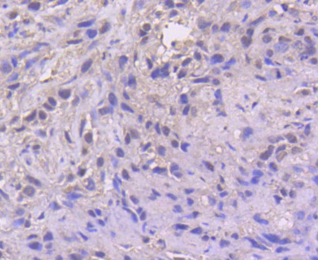 Anti-ATF-4 Antibody (7M603)