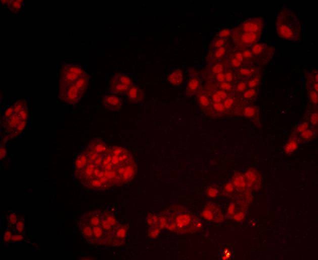 Anti-BMI-1 Antibody (8M743)