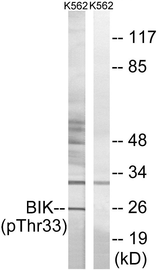 Anti-Phospho-BIK (Thr33) Polyclonal Antibody