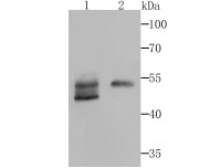 Anti-Biglycan Antibody (9V222)