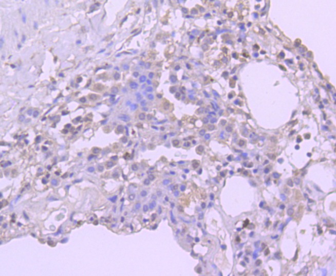 Anti-BMI-1 Antibody (4I124)