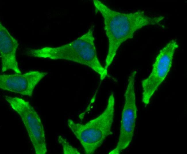 Anti-BMAL1 Antibody (5D959)