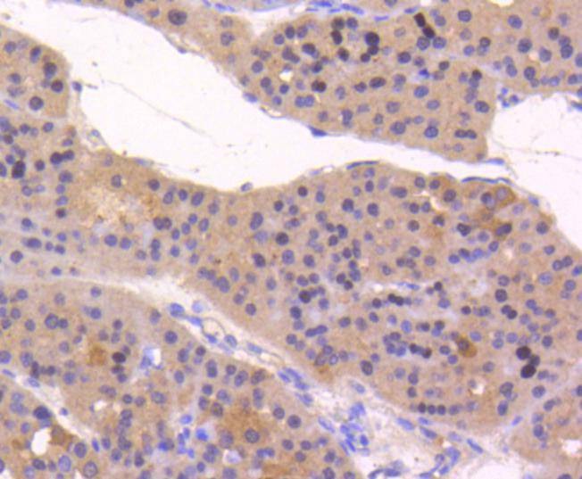 Anti-ATF-5 Antibody (6Y194)