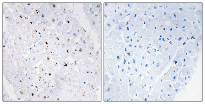 Anti-Phospho-BLM (Thr99) Polyclonal Antibody 2