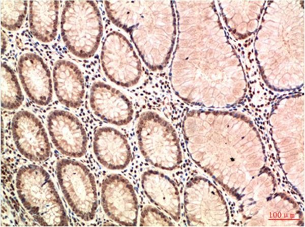 Anti-ATM Antibody (1W166)