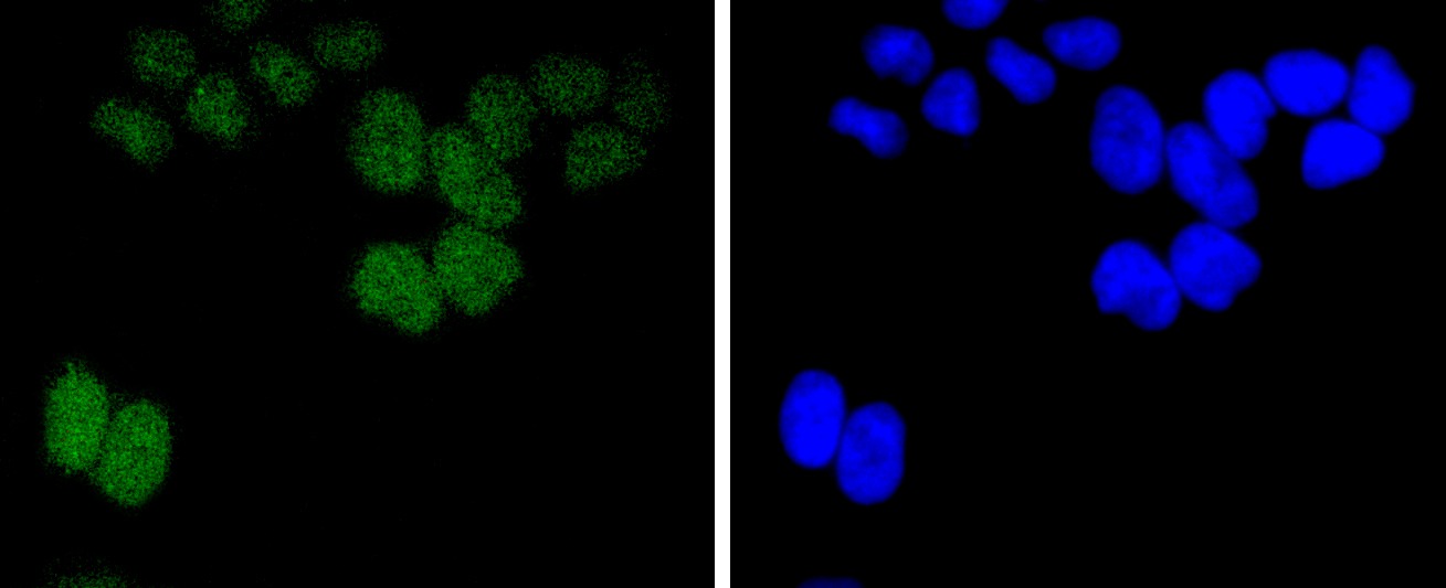 Anti-BMI-1 Antibody (4I124)