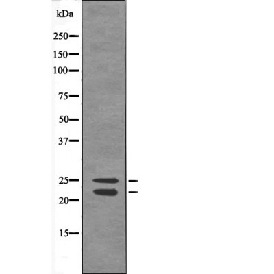 Anti-Phospho-Bim (Ser44, 104) Polyclonal Antibody