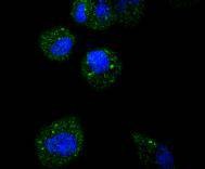 Anti-ATF-5 Antibody (6Y194)