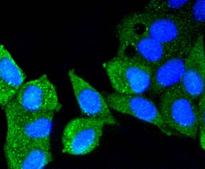 Anti-ATM Antibody (9B624)