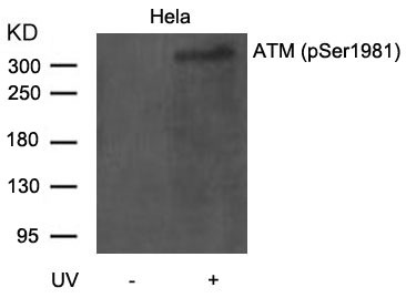 Anti-Phospho-ATM (Ser1981) Polyclonal Antibody