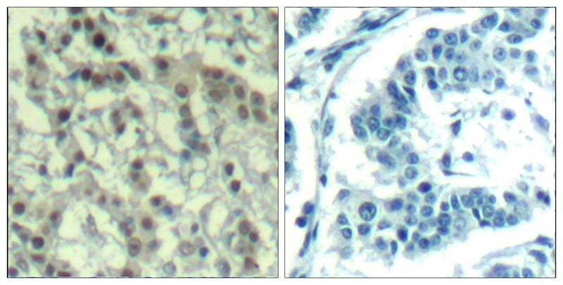 Anti-Phospho-AURKA (Thr288) Polyclonal Antibody
