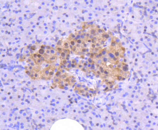 Anti-ATM Antibody (9B624)