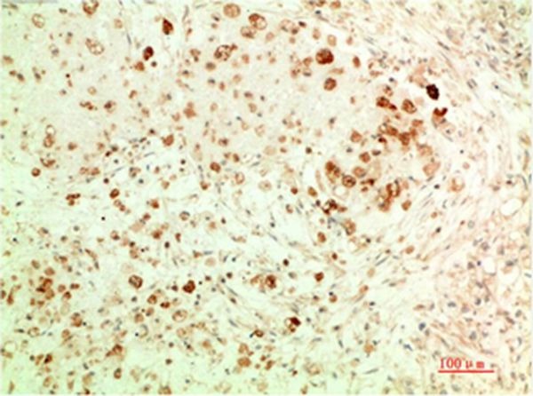 Anti-ATG5 Antibody (3M169)