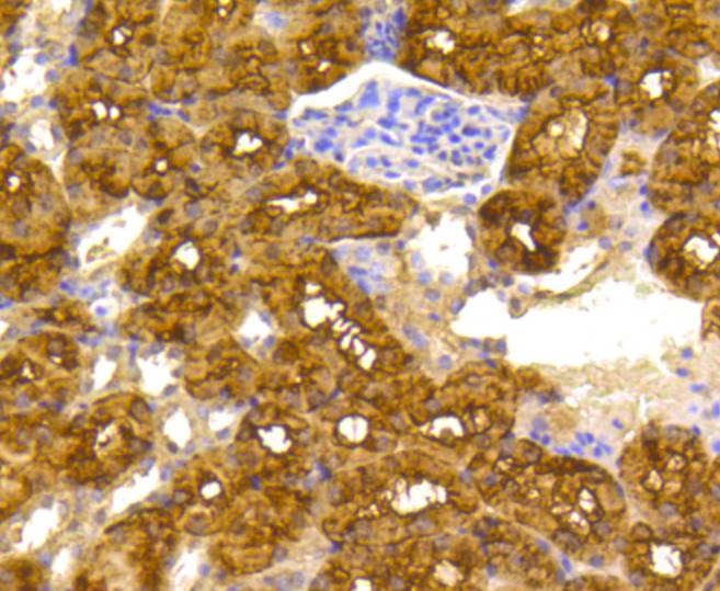 Anti-ATP citrate lyase/ACLY Antibody (8R855)
