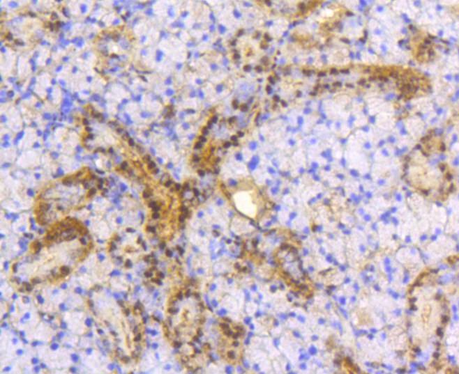 Anti-ATP citrate lyase/ACLY Antibody (8R855)