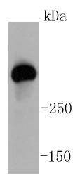 Anti-ATM Antibody (9B624)