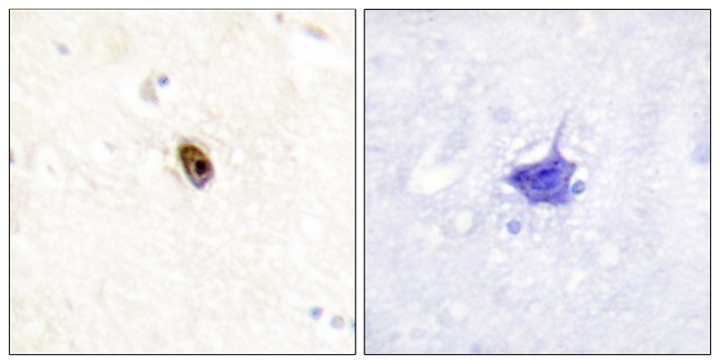 Anti-Phospho-AurB/C (Thr236/202) Polyclonal Antibody
