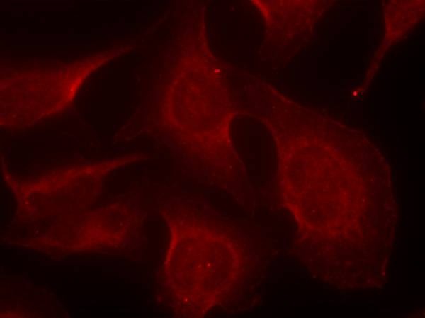 Anti-Phospho-Bim (Ser69) Polyclonal Antibody
