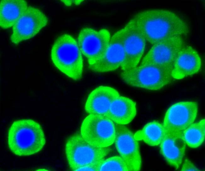 Anti-ATP citrate lyase/ACLY Antibody (8R855)