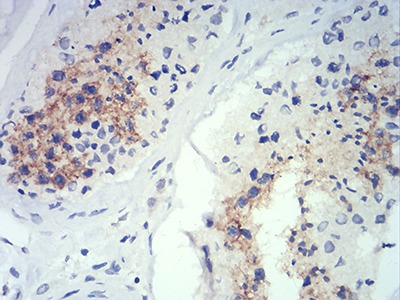 Anti-ATG14 Antibody (6F903)