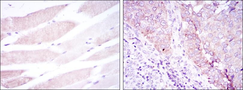 Anti-BMPR2 Antibody (9I236)