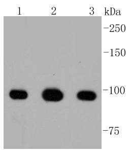 Anti-ATP citrate lyase/ACLY Antibody (8R855)
