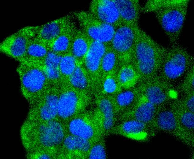 Anti-ATG9A Antibody (7P88)