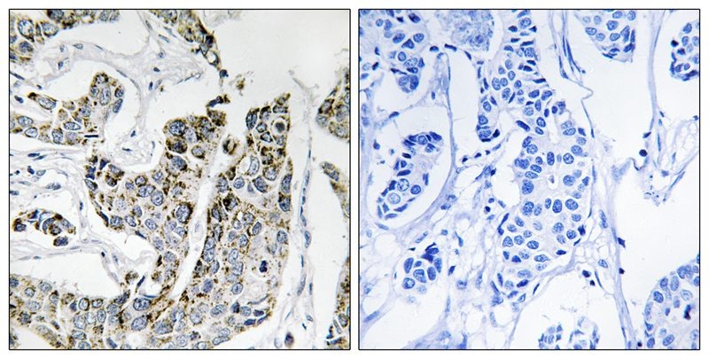 Anti-Phospho-BLK (Tyr501) Polyclonal Antibody