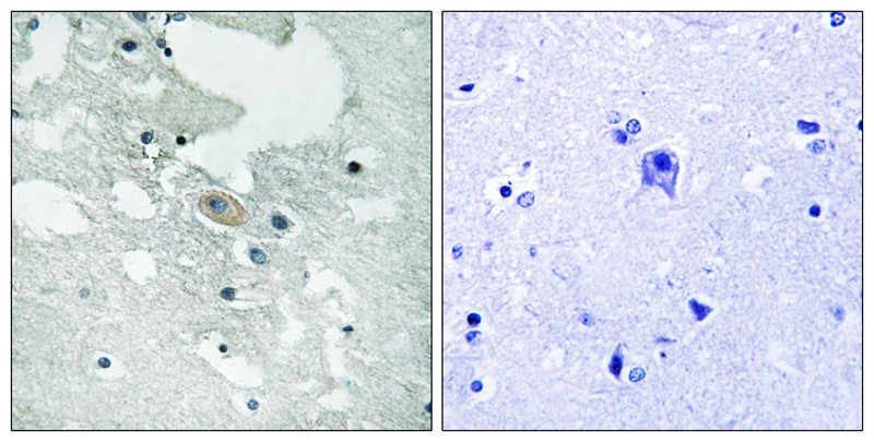 Anti-Phospho-BLNK (Tyr84) Polyclonal Antibody