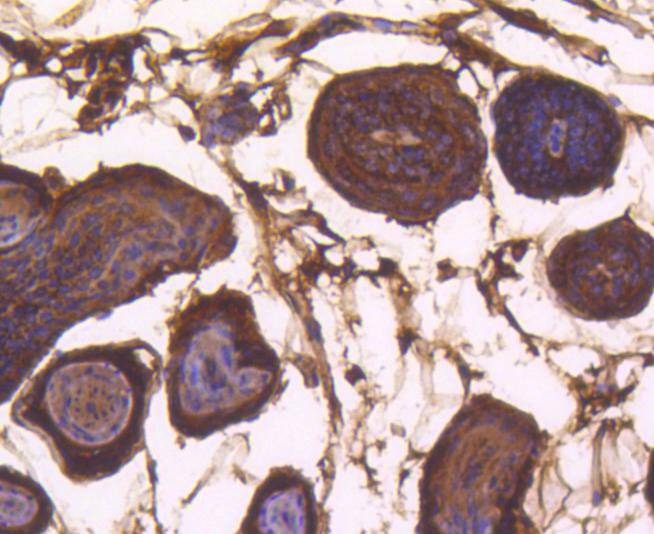 Anti-BAX Antibody (1J827)