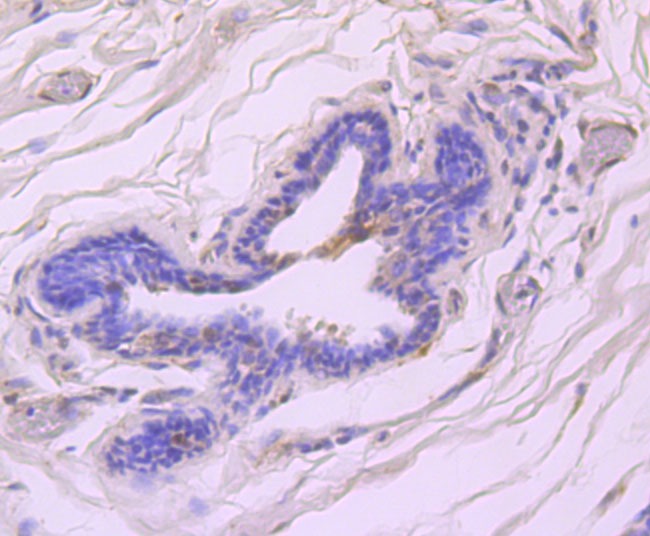 Anti-Phospho-ATM (Ser1981) Antibody (4B419)