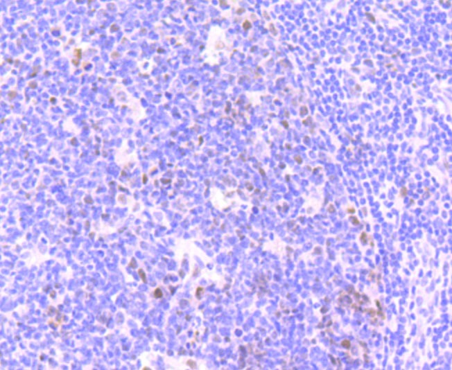 Anti-Phospho-ATM (Ser1981) Antibody (4B419)