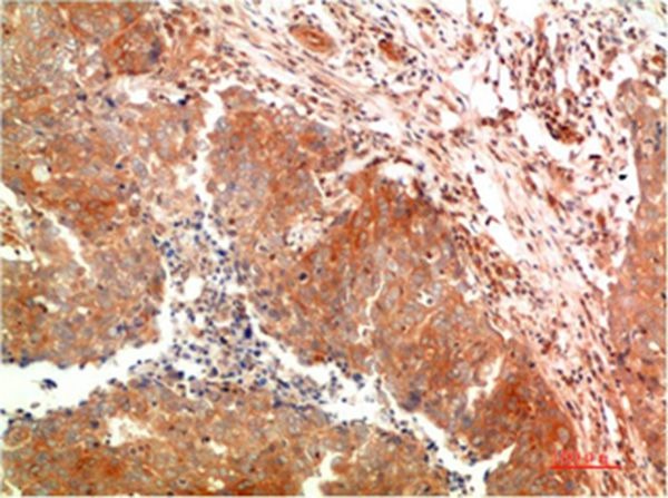 Anti-ATG5 Antibody (3S196)